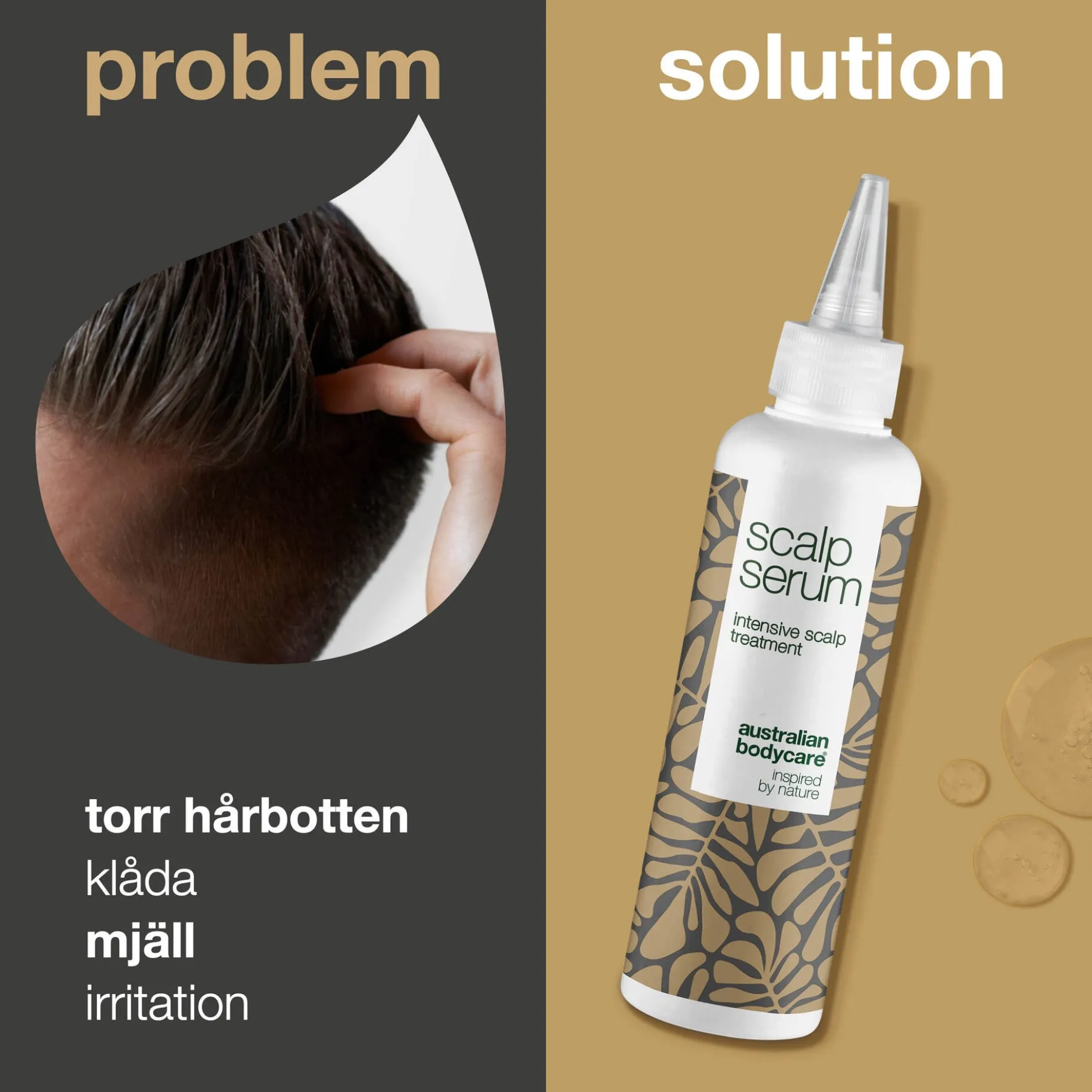 Australian Bodycare Scalp Serum mot mjäll, torr och kliande hårbotten 150 ml