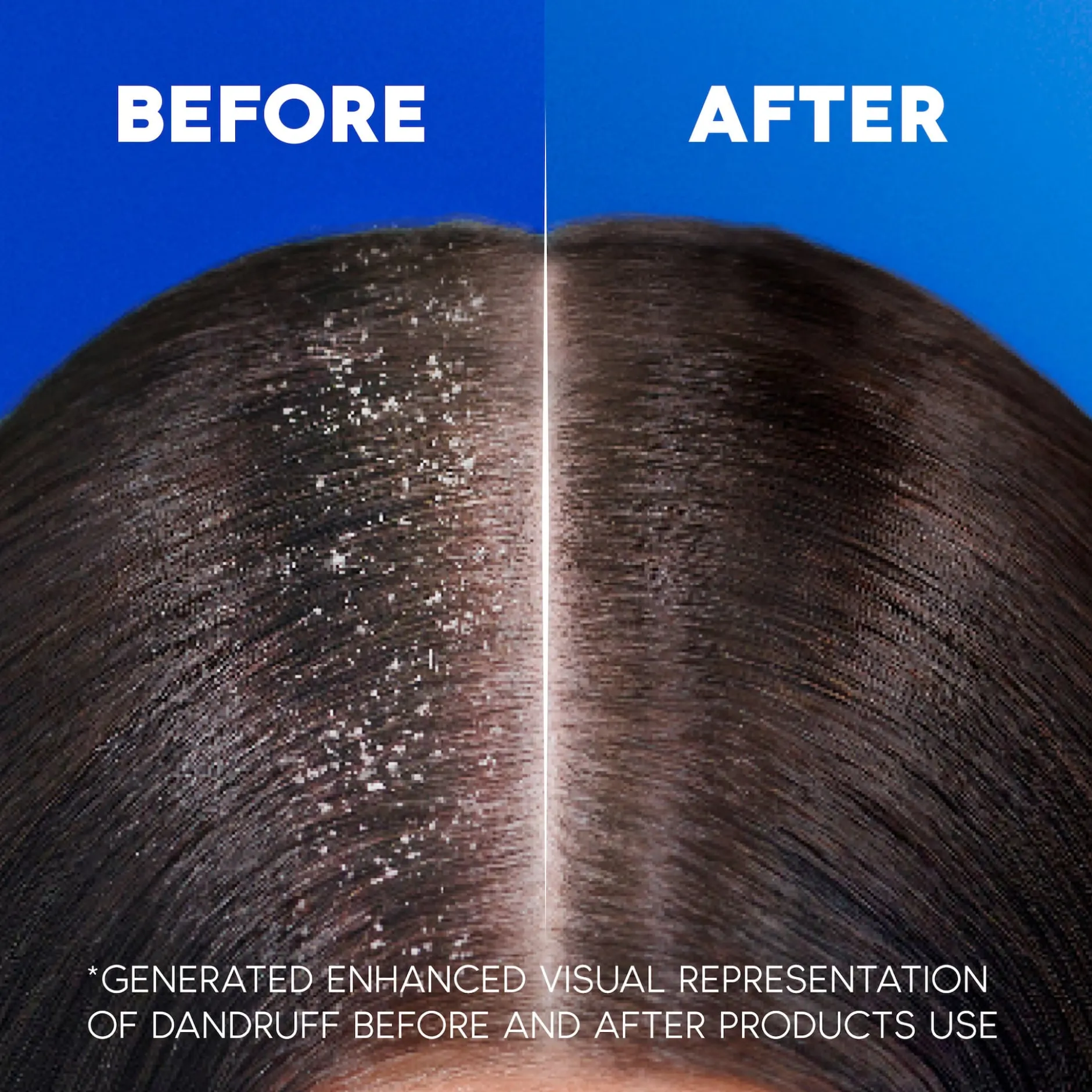 Head & Shoulders Citrus Fresh Mjällschampo för fett hår 500 ml