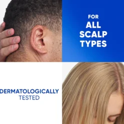 Head & Shoulders Dry Scalp Schampo mot mjäll 250 ml