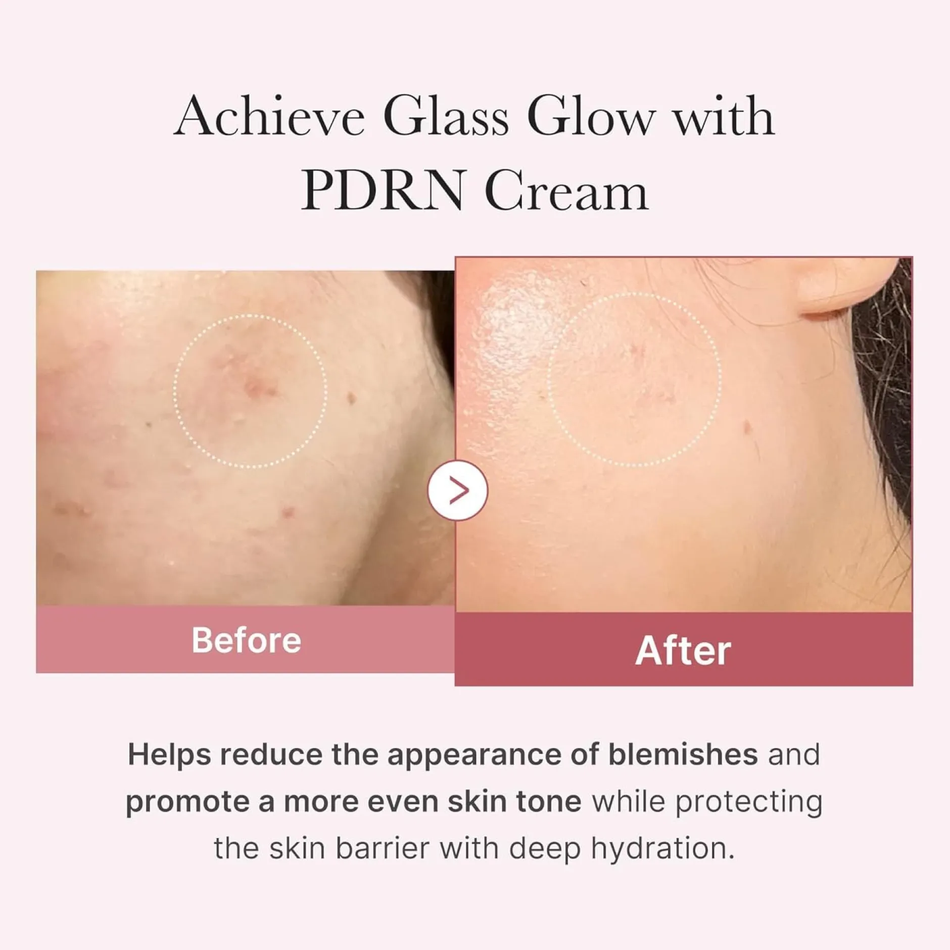 Medicube PDRN Pink Hyaluronic Moisturizing Cream 50 ml