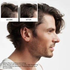 Nioxin System 2 Loyalty Kit