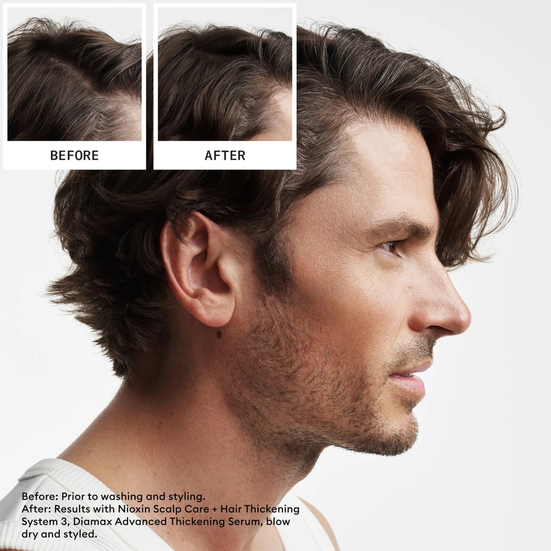 Nioxin System 2 Loyalty Kit