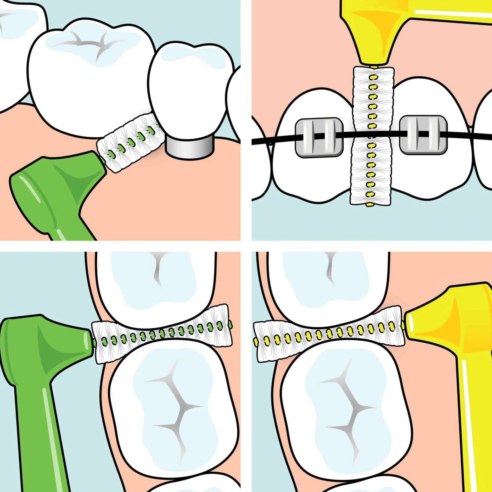 TePe Angle Vinklad Mellanrumsborste 0,5mm Röd 6-pack