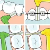 TePe Angle Vinklad Mellanrumsborste 0,4mm Rosa 6-pack