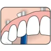 TePe Universal Care Vinklad borste 1-pack