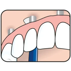 TePe Universal Care Vinklad borste 1-pack