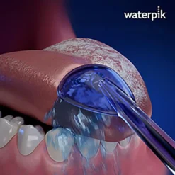 Waterpik TC-100E Water Flosser Tongue Cleaner